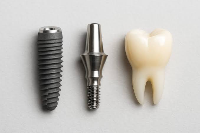 Iplant Dentist in Agoura Hills